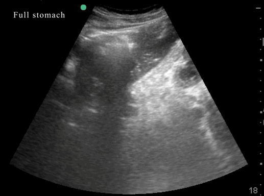 EEU case image missing